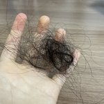 <b>몇주전</b>부터 머리가 ㅈㄴ 빠지는데