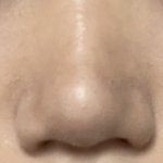[의견부탁] 코 <b>쉐딩</b>