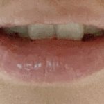웃을때 <b>앞니</b> 보이는거 킹받음…