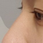 [드루와] 코수술<b>여부</b>ㅈㅂ