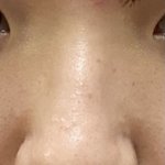 나 심각한 <b>복코</b>임?