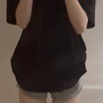 허벅지는 진짜 지흡밖에 답없는건가