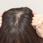 [댓글부탁해] 남잔데 여자들 <b>정수리</b> 탈모 왜그런거임