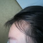 헤어라인왁<b>싱</b>망함