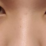 [드루와] <b>코수술</b>