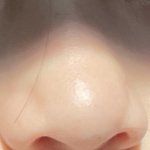 이런 복코는 어케해야하냐