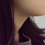 [댓글부탁해] 나 <b>무턱</b> 심한편이야?