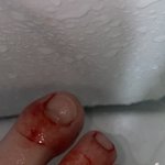 [드루와] 극혐주의)<b>발가락</b>털 깍다가 ㅈ됨