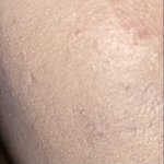 쿠션바르다가 급<b>발진</b>함