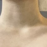 [<b>빛삭</b>] 나 어깨 승모근 심한 거임???