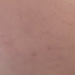 피부과 레이저 잘아는애<b>등아</b>