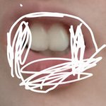나 <b>앞니</b> ㅈㄴ 큰데 대결할사람
