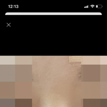 <b>코수술</b> 이게 가능함?