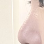[댓글부탁해] 니들이 내 <b>코</b>면 수술 할거임?