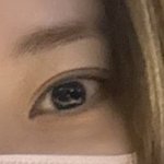 나 눈 이렇게 생겼는데 <b>재수술</b> 할말