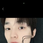 [NCT드림] 나는 얘가 <b>사랑니</b> 뺀 위치 직접