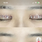 쌍수 이건 <b>대체</b> 무슨 방법임??