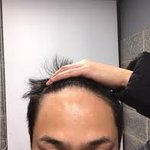 내 <b>이마</b>어때 많이 넓음?