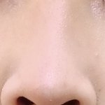 나같은 코는 어케 <b>수습</b>해야하냐