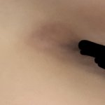 아 나 눈 <b>착색</b> 개심해