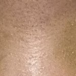 쌍수 4일차(하루만에 이렇게 달라질수잇<b>뉴</b>?)