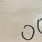[댓글부탁해] 여드름 잘<b>알들</b>아 들어와바
