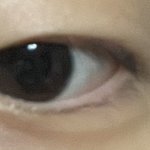 나 쌍수할까??