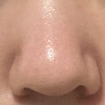 나 코 비대칭 ㅈㄴ심해