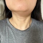 [모병원때문] 하루만에 동생을 잃을 뻔 했습니다.