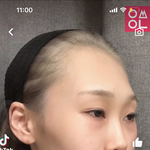 [드루와] 성형수술로 이게됨????