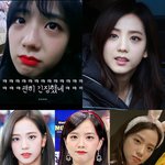 지금 쌍수하는거 <b>에바</b>임?