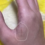 이거 <b>흉터</b>임??