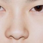 나 코<b>보정</b> 잘하지않음???