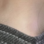 이거 <b>눈밑필러</b> 맞아야겠지?