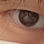<b>판녀</b>의 쌍수 후기