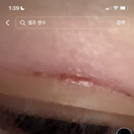 [댓글부탁해] ㅅㅂ 틱톡에 <b>셀프</b>쌍수한 애 봄?