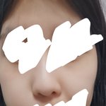피부눈 <b>유전</b>임