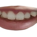 <b>덧니</b> 교정 해야할것 같애?