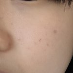 [드루와] 피부과 갈까?