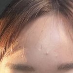 [댓글부탁해] 나 <b>이마</b> 많이 넓어..?
