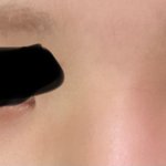 나 다크써클 <b>심해</b>보여??