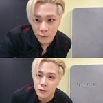 팬들이 충격에 빠진 아스트로 <b>문빈</b> 붓기 발언