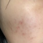 노스<b>카나</b> 15일차