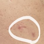 [댓글부탁해] 이거 피부에 상처난거야??