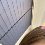눈썹<b>탈색</b>했는데 피부난리남 이거어떡함