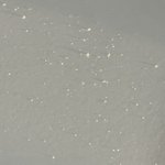 [드루와] 나 방금 머리 감았는데 <b>비듬</b>