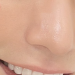 이빨 <b>라미</b> 한건가??