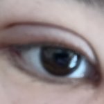 이거 <b>쌍수</b> 부작용 아니지??