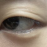 나 <b>쌍수</b> ㅈㄴ 잘됨