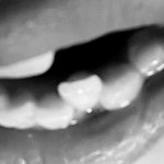 아니 나 이가 예전보다 뒤로 <b>이동한</b> 거 같은데